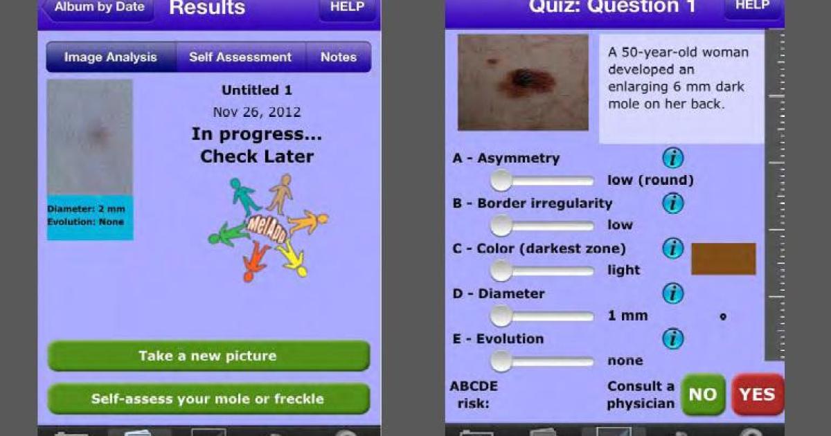 Ftc Cracks Down On Deceptive Skin Cancer Apps Digital Trends