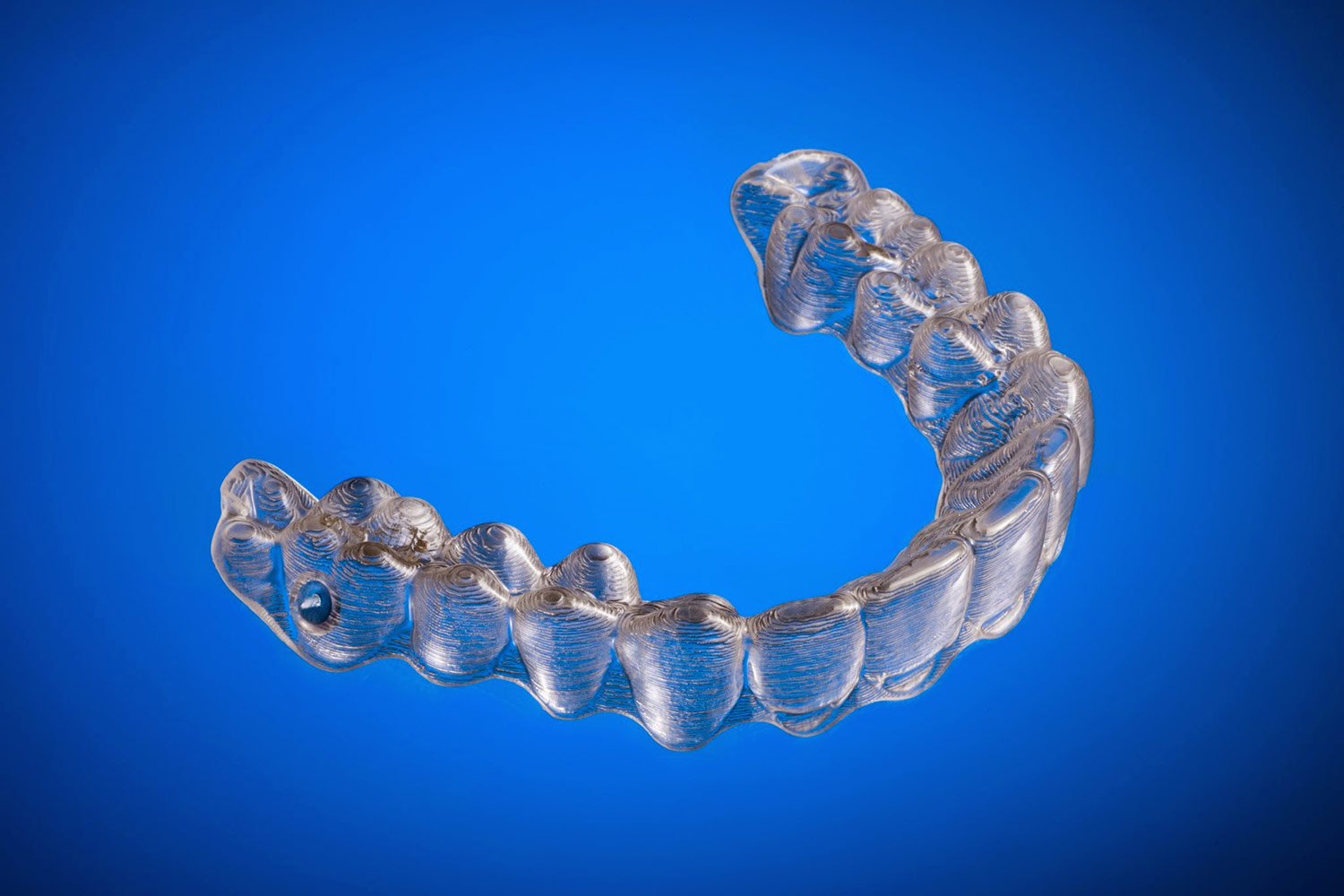 DIYer Straightens Teeth Using 3D-Printed Invisalign Braces | Digital Trends