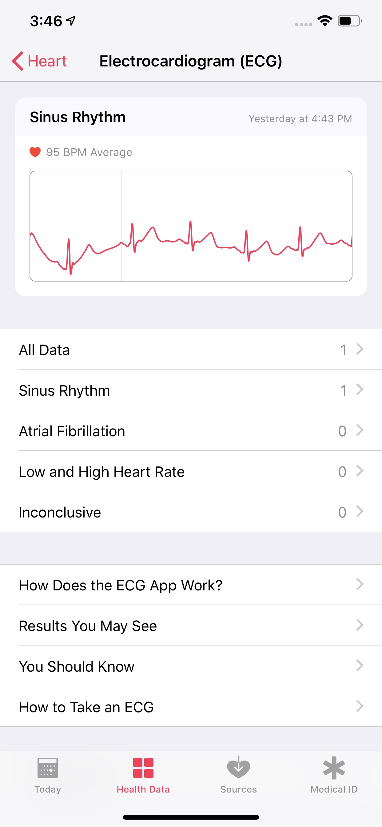 Apple watch take discount ecg