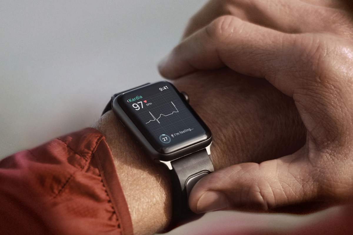 KardiaBand outperforms Apple Watch in diagnosing AFib, but a cardiologist's  perspective is still crucial