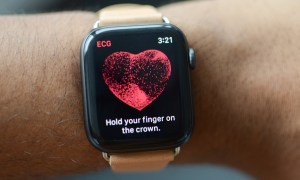 wearable devices leading to over diagnosis apple watch ekg feat