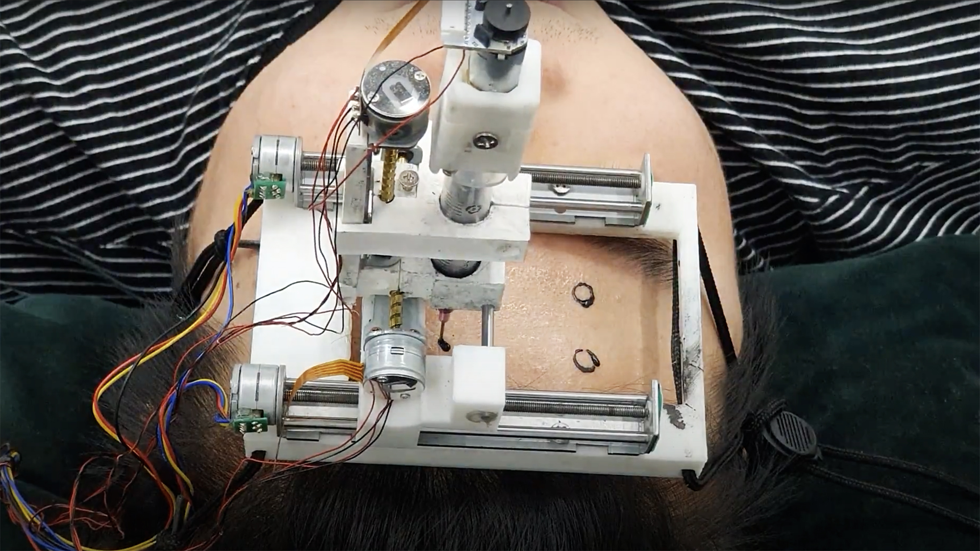 A Graphene Tattoo To Continuously Monitor Your Brainwaves | Digital Trends