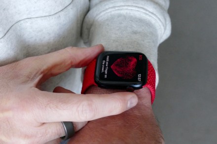 You have another reason to use your Apple Watch’s ECG feature