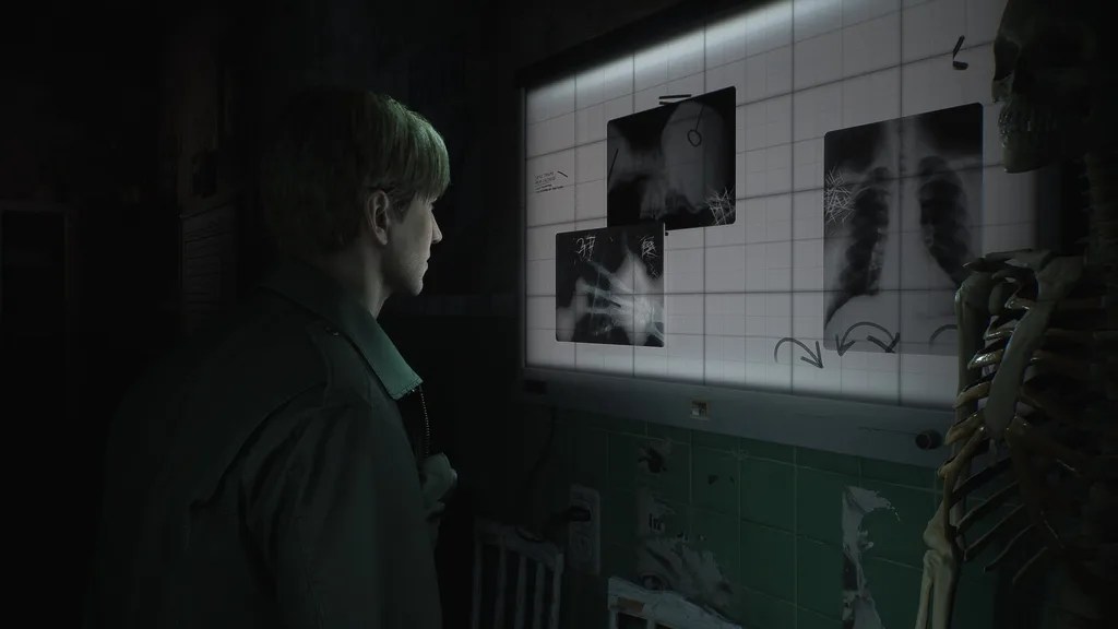 Silent Hill 2 Remake Release Date Has Been Revealed?