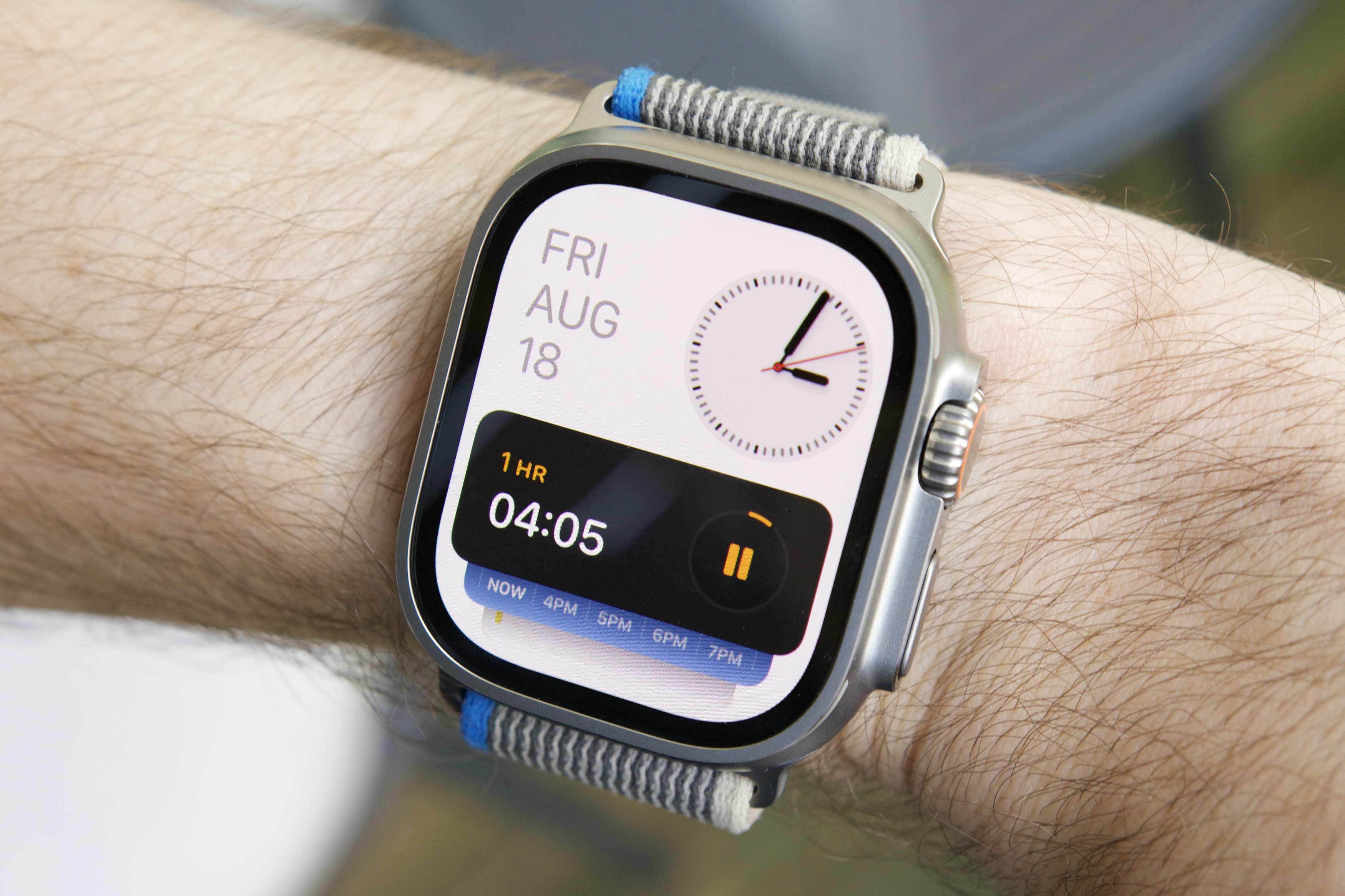 Un Apple Watch para controlar la diabetes sin aguja, cada vez más