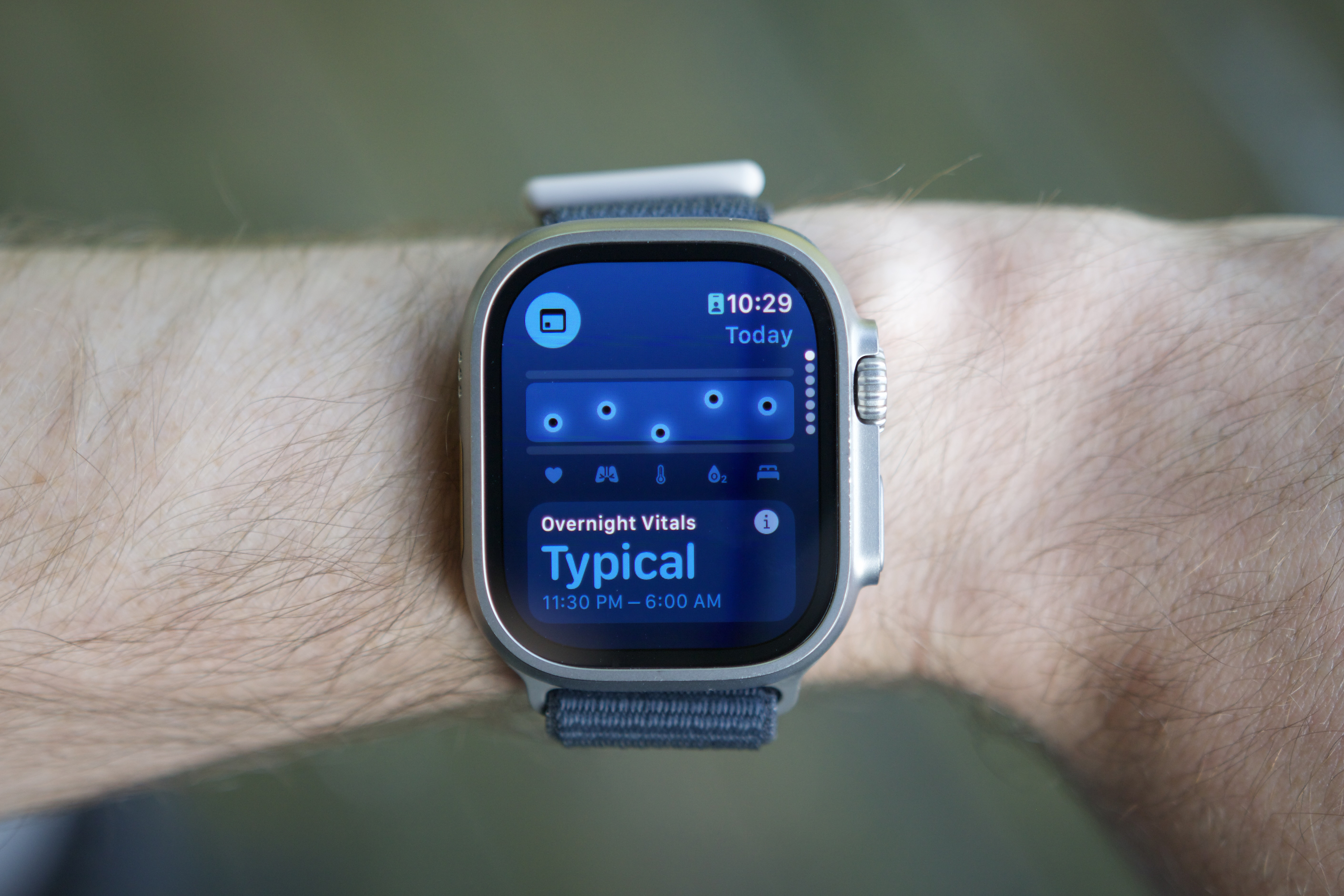 Vitals is one of the best Apple Watch apps I’ve used in years