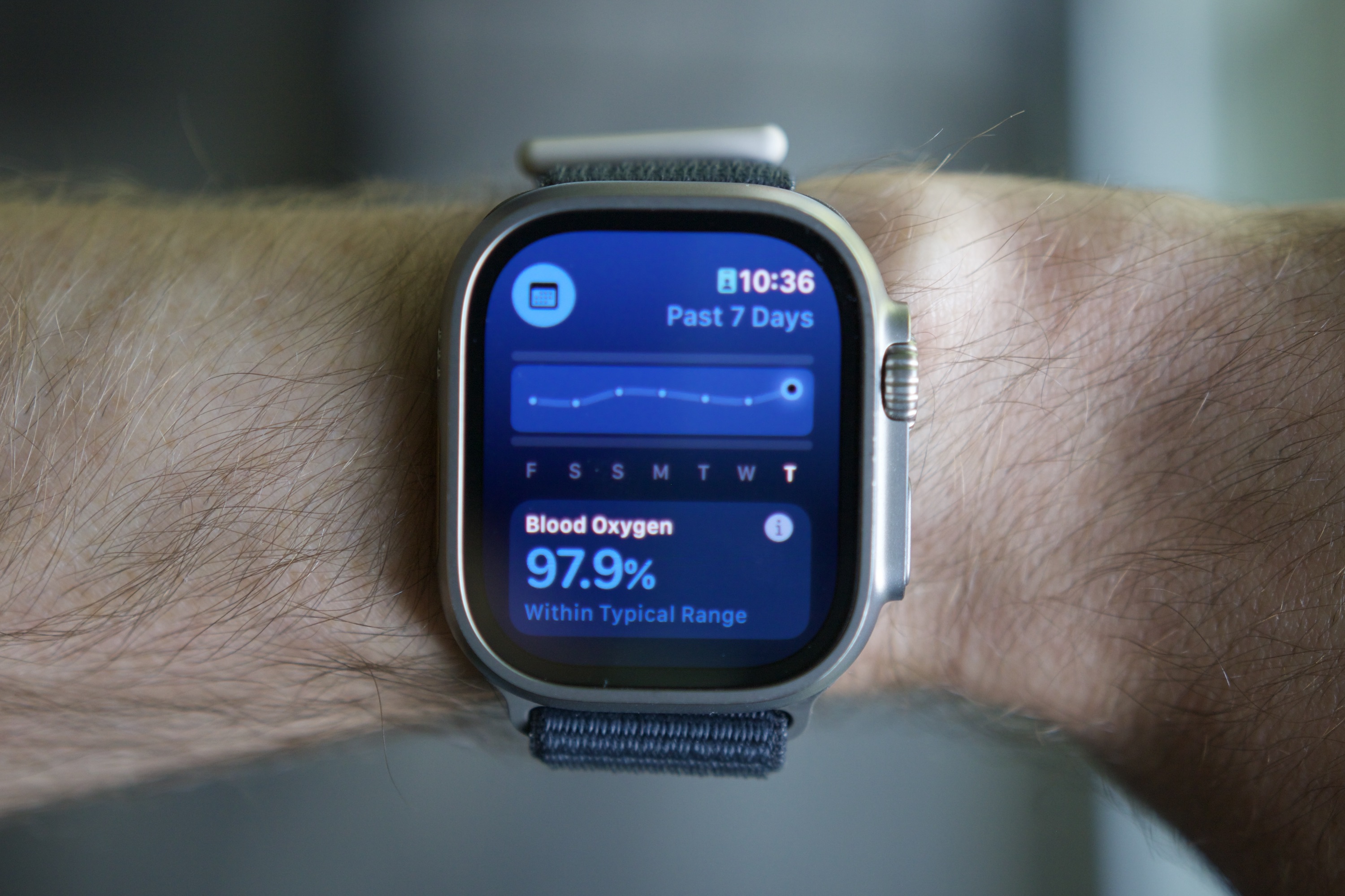 Vitals is one of the best Apple Watch apps I’ve used in years