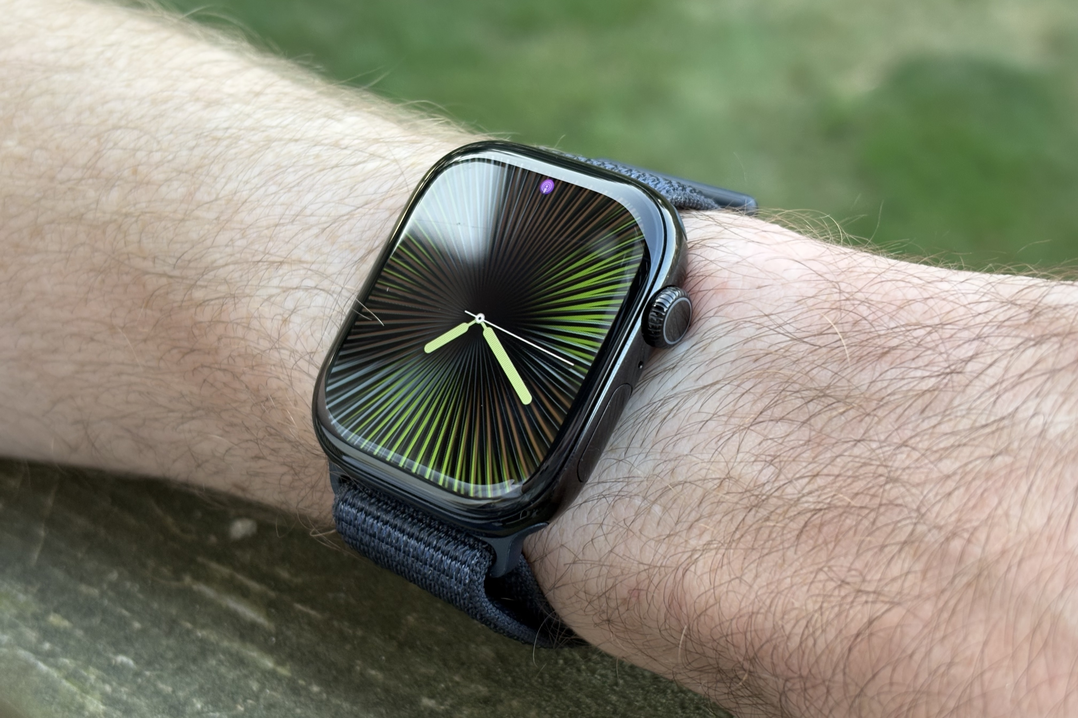 Alguém usando o Apple Watch Series 10 e apoiando o braço