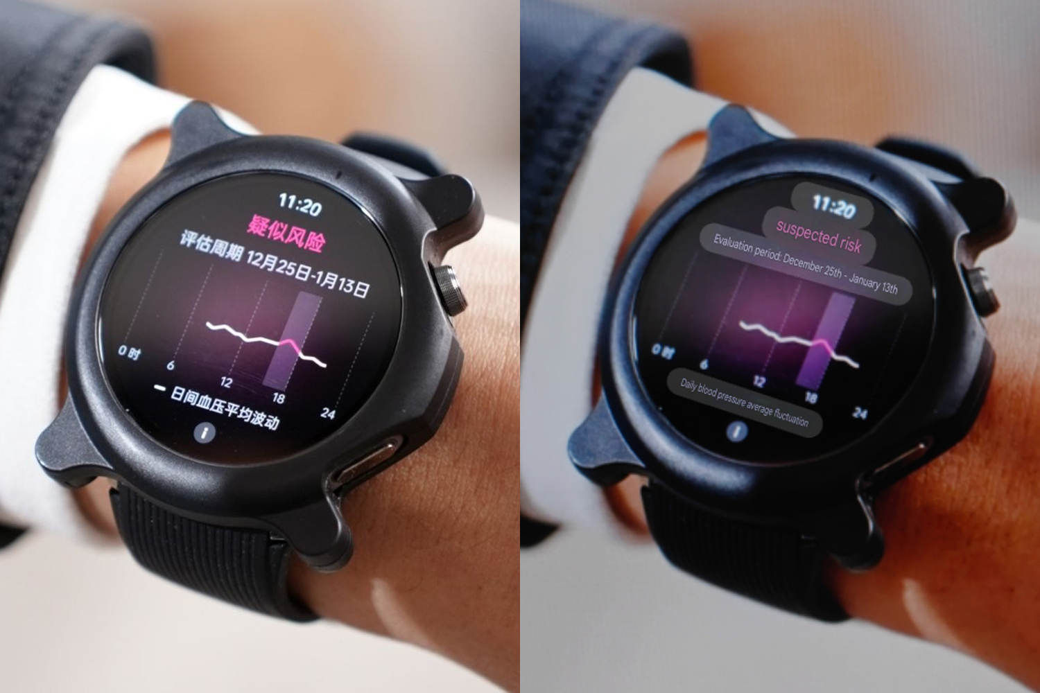 Oppo watch x2 oneplus watch 3 monitor de pressão arterial.