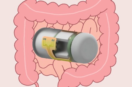 This ingestible smart capsule can wirelessly monitor gut health in real time